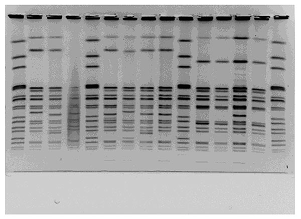 Pulsed-field gel electrophoresis patterns of XbaI-digested multidrug-resistant Salmonella Newport