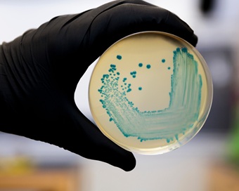 Listeria monocytogenes isolated on agar from a food sample.