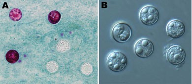 Cyclospora cayetanensis oocysts